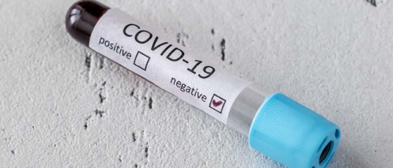 Read more about the article Trucking companies brace for Coronavirus impact